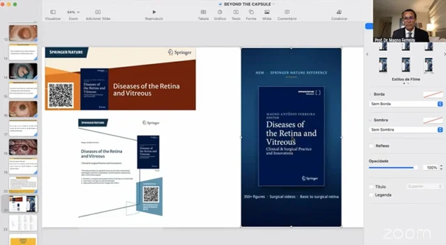 Dr. Magno Apresenta o Livro: Diseases of the Retina and Vitreous